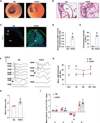 Autophagy Contributes to the Rapamycin-Induced Improvement of Otitis Media